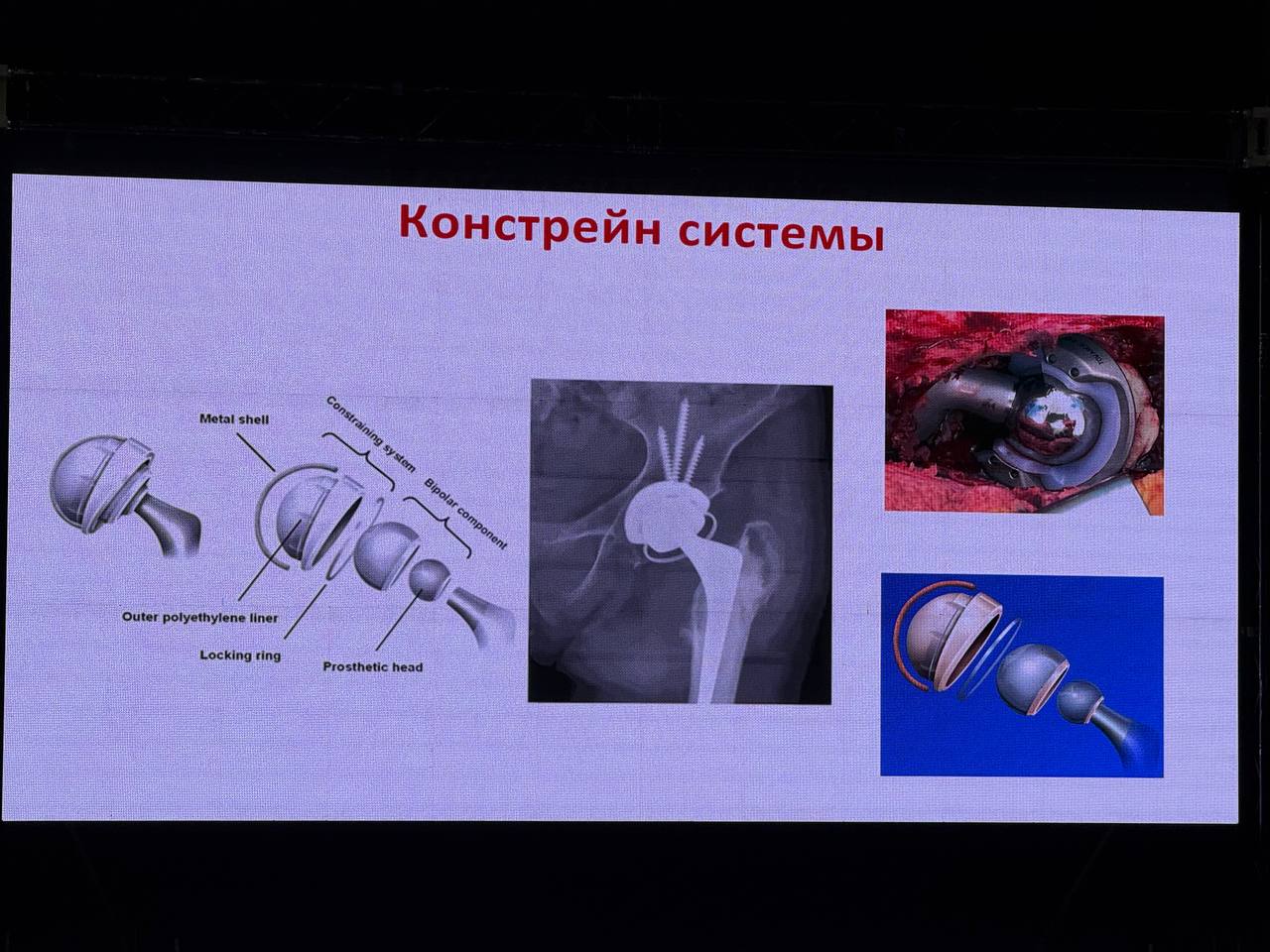 Врачи травматологи‑ортопеды Махачкалинской клинической больницы приняли участие в Южно‑Российском ортопедическом научно‑образовательном форуме